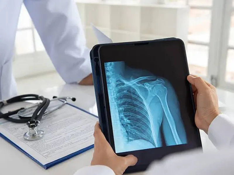 Digital X-Rays